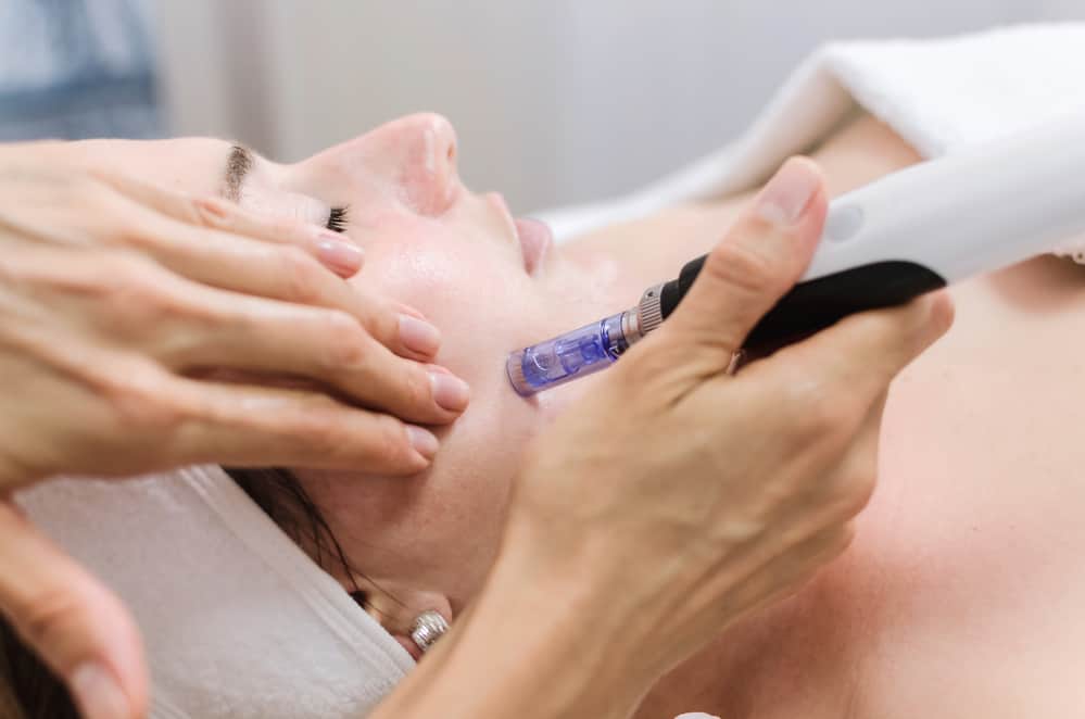 Say Goodbye To Wrinkles: How SkinPen Micro-Needling Is Changing The Game